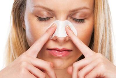 Rhinoplasty
