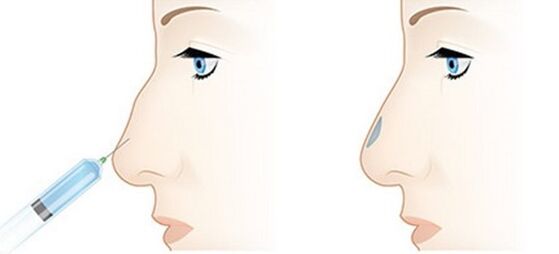 The procedure allows you to set different problems