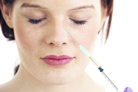 Non-surgical rhinoplasty with fillers